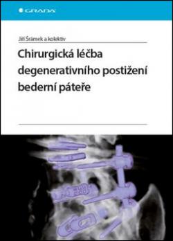 Chirurgická léčba degenerativního postižení bederní páteře