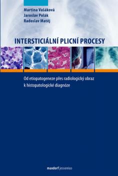 Intersticiální plicní procesy - Od etiopatogeneze přes radiologický obraz k histopatologické diagnóze