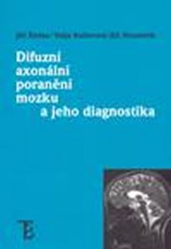 Difuzní axonální poranění mozku a jeho diagnostika