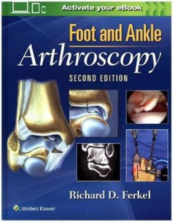 Foot & Ankle Arthroscopy, 2nd Ed.