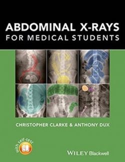 Abdominal X-Rays for Medical Students