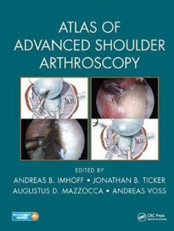 Atlas of Advanced Shoulder Art