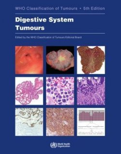 Digestive system tumours