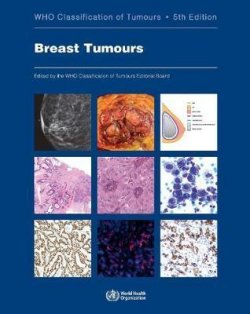 WHO classification of tumours of the breast