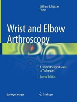 Wrist and Elbow Arthroscopy: A Practical Surgical Guide to Techniques