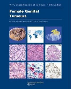 Female Genital Tumours: WHO Classification of Tumours (Medicine) 5th Edition