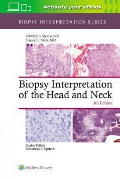 Biopsy Interpretation of the Head and Neck