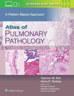 Atlas of Pulmonary Pathology : A Pattern Based Approach