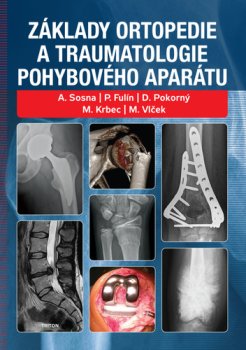 Základy ortopedie a traumatologie pohybového aparátu
