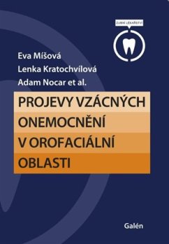 Projevy vzácných onemocnění v orofaciální oblasti